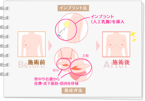 施術前 施術後