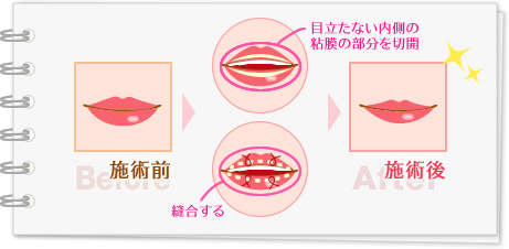 施術前 施術後