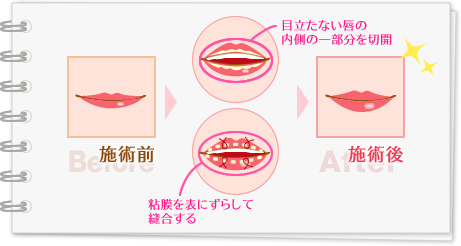 施術前 施術後